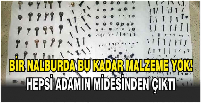 Bir nalburda bu kadar malzeme yok! Hepsi adamın midesinden çıktı