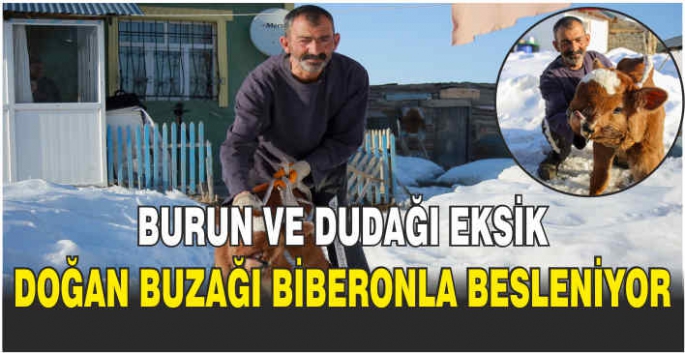 Burun ve dudağı eksik doğan buzağı biberonla besleniyor