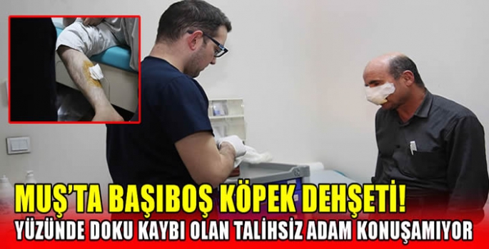 Muş'ta başıboş köpek dehşeti! Yüzünde doku kaybı olan talihsiz adam konuşamıyor…