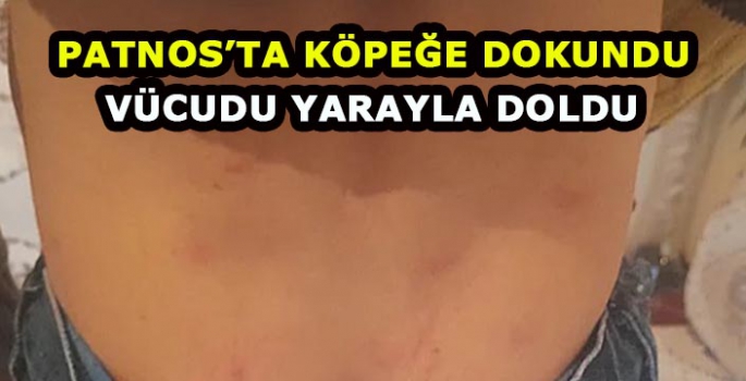 Patnos'ta köpeğe dokunan çocuğun vücudunda yaralar çıktı