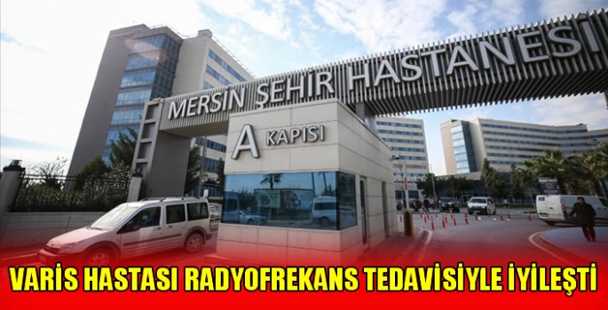 Varis hastası radyofrekans tedavisiyle iyileşti