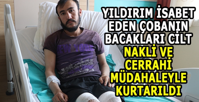 Yıldırım isabet eden çobanın bacakları cilt nakli ve cerrahi müdahaleyle kurtarıldı